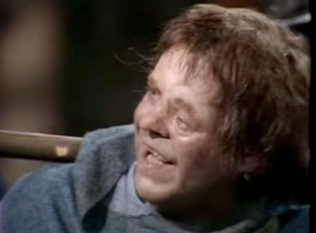  Warren Clarke as Quasimodo 1977 The Hunchback of Notre Dame picture image
